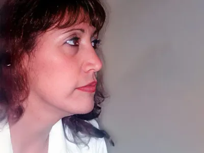 Fotografía clínica de planificación de tratamiento de ortodoncia